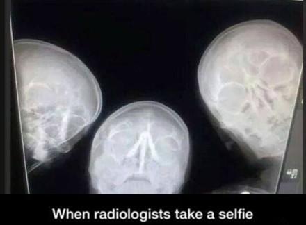 放射科医生也玩自拍=.= 他们需要神经科医生的